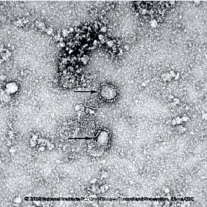 新型冠狀病毒疫苗和治療藥物正加速研制！